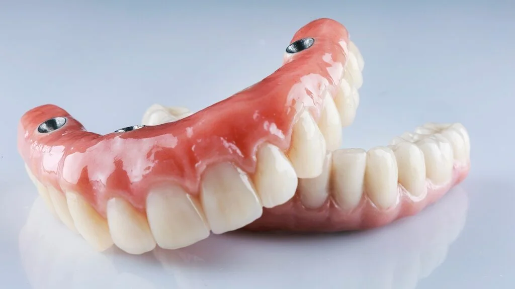 Quality Tooth Replacement Options That Fit Your Budget