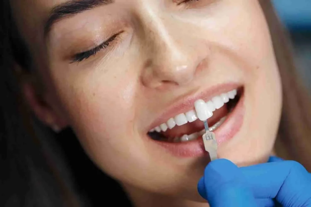 Advanced Dental Veneers Technology Redefines the Art of a Perfect Smile