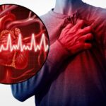 Congestive Heart Failure