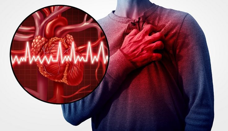 Congestive Heart Failure