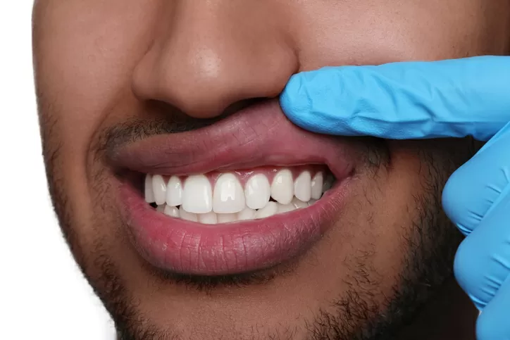 Gum Treatments for Enhanced Oral Health