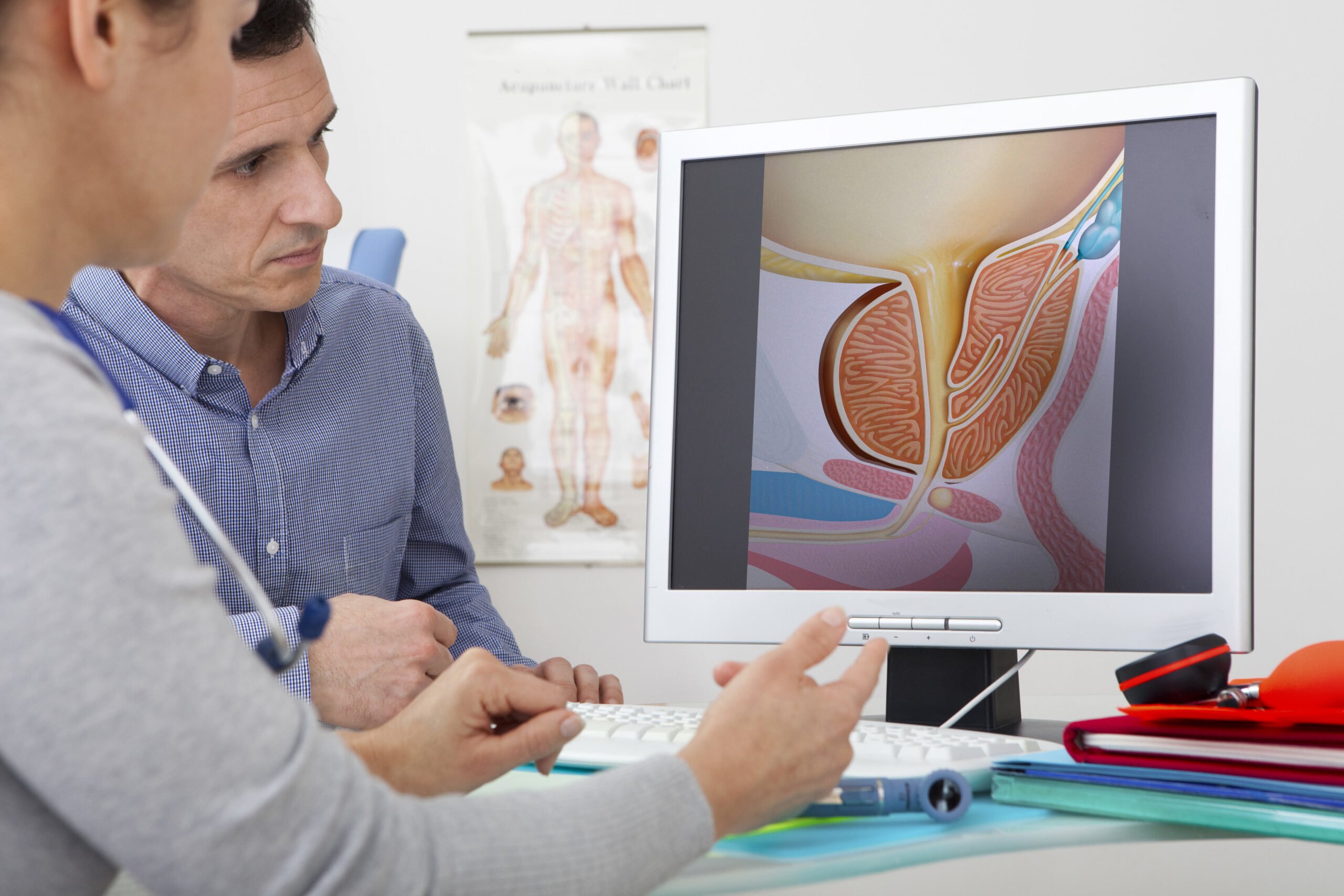 Prostate Cancer Doctor