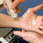 Types of Neuropathy