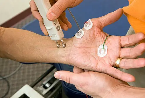 Types of Neuropathy